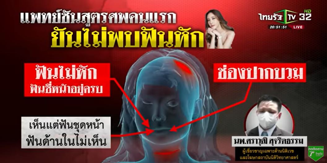 karasuwich1's tweet photo. ดีใจที่คุณแม่คุณแตงโมกับคุณทนายยังสงสัยในหลายๆ จุด 
ตอนแรกก็นึกว่าไม่ติดใจแล้ว
เพราะหลายๆ คนก็ยังติดใจในประเด็นของบาดแผลหลายๆ จุด
จริงๆ ถ้าตำรวจมั่นใจว่าเป็นอุบัติเหตุ ก็น่าจะเปิดเผยคลิป
ถ้าบอกวายังไม่ชัด แล้วมั่นใจได้ยังไงว่าที่เห็นตรงท้ายเรือคือคุณแตงโม
#ทวงความยุติธรรมให้แตงโม https://t.co/GfbGbus1jz