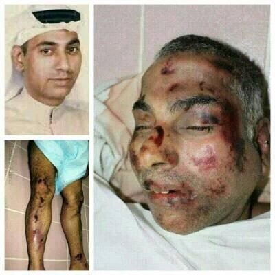 abuturab1110's tweet photo. #الشهيد_عيسى_رضي وهو من ضمن من تقدموا باتجاه مدخل سترة الرئيسي في يوم #مجزرة_سترة لصد هجوم قوات المرتزقة المدعومة بالإحتلال السعودي الاماراتي، اعتقل منذ اول يوم الغزو الارهابي على سترة وتم العثور عليه بعد يومين من المجزرة في منطقة مدينة عيسى، مقتول مهشم الجسد ومفضوخ الرأس https://t.co/mzRxNZQMlz