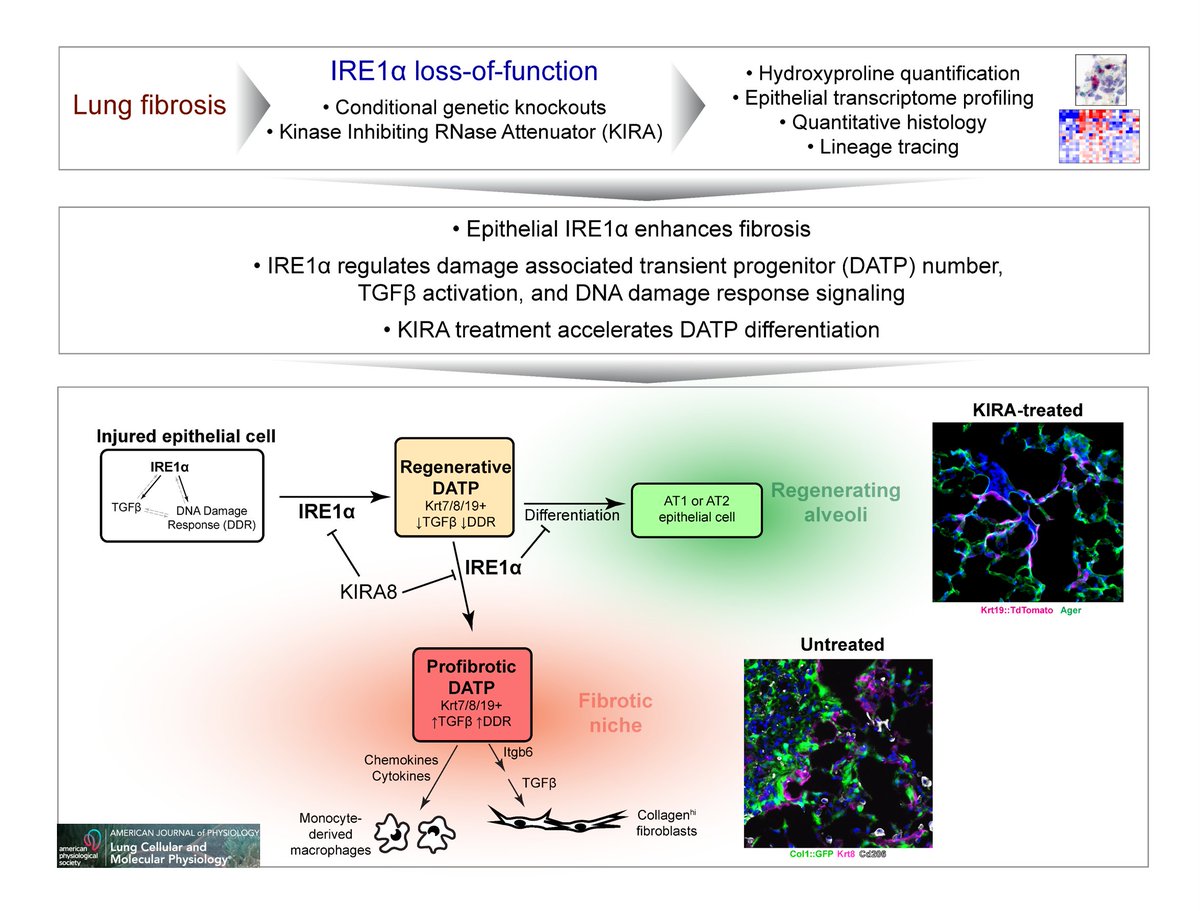 AJPLung's tweet photo. IRE1α drives lung epithelial progenitor dysfunction to establish a niche for #pulmonaryfibrosis

New #ResearchArticle by @UCSFDOM and @QBI_UCSF authors: https://t.co/x74M3nQbLB

#ArticlesInPress #LungRegeneration #ProgenitorCells https://t.co/eBsmoohgiX