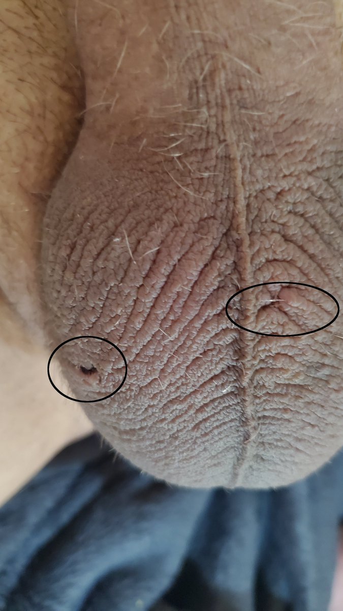 ForQos's tweet photo. It is totally official, I can no longer make #whitebabies with my #QOS #hotwife, the only way she is getting pregnant is with a #bigblackcock now. The circles are proof of the incisions

#saynotowhiteboys #teamblackguys #qos #queenofspades #blacksupremcy #BNWO #cuckold https://t.co/WPLyUcCWMH