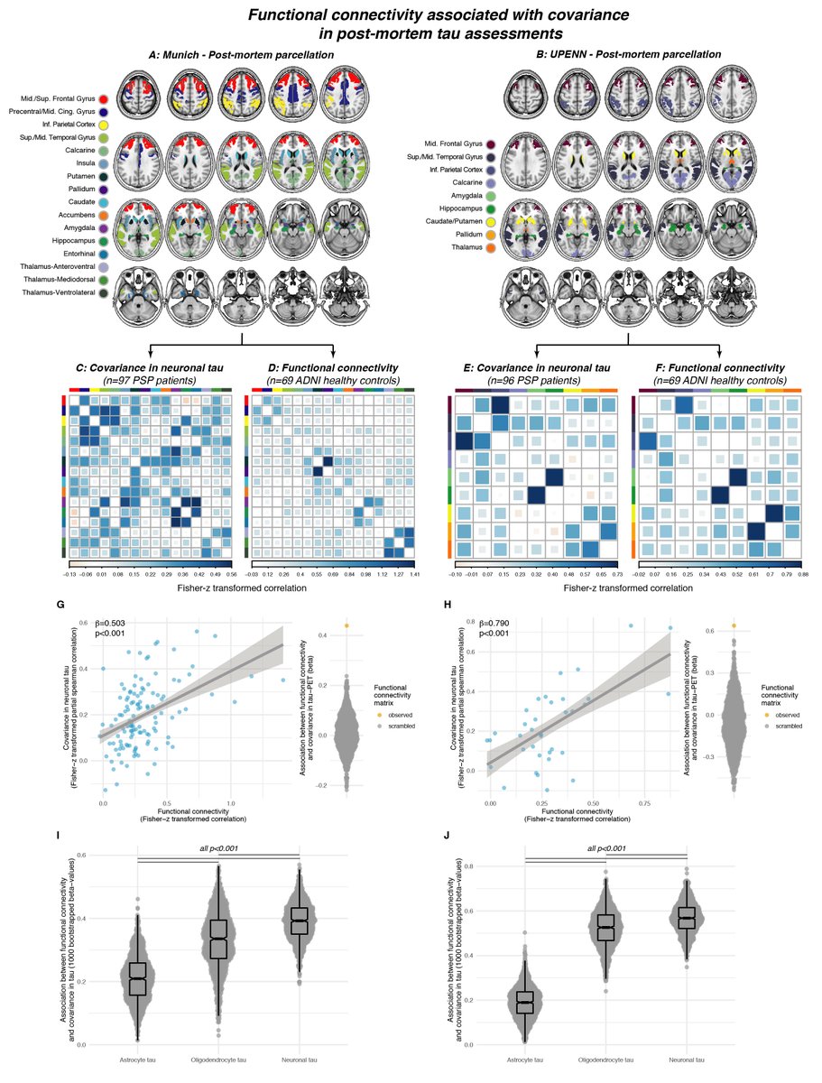 Nico Franzmeier (@nfranzme) on Twitter photo Happy to share our new work out in <a href="/NatureComms/">Nature Communications</a>: Tau deposition patterns are associated with functional connectivity in 4R tauopathies, using PET and post-mortem data. Thanks to co-first author <a href="/matbrendel/">MatthiasBrendel</a>, <a href="/MichaelEwers12/">Michael Ewers</a>
@GunterHoglinger and many others! rdcu.be/cI029 Happy to share our new work out in <a href="/NatureComms/">Nature Communications</a>: Tau deposition patterns are associated with functional connectivity in 4R tauopathies, using PET and post-mortem data. Thanks to co-first author <a href="/matbrendel/">MatthiasBrendel</a>, <a href="/MichaelEwers12/">Michael Ewers</a>
@GunterHoglinger and many others! rdcu.be/cI029