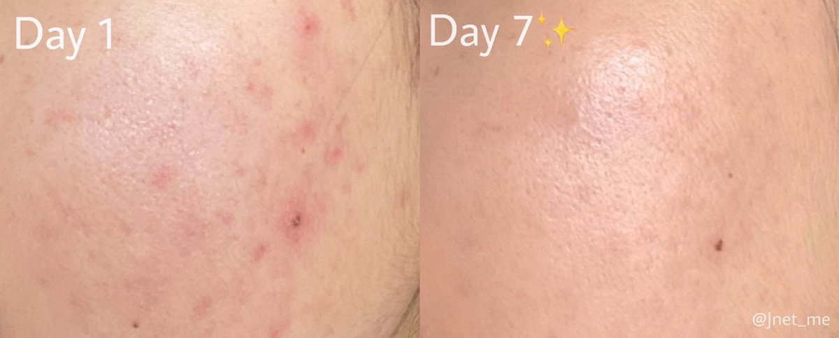 🧸JanisReviews🍪🐻 tweet media