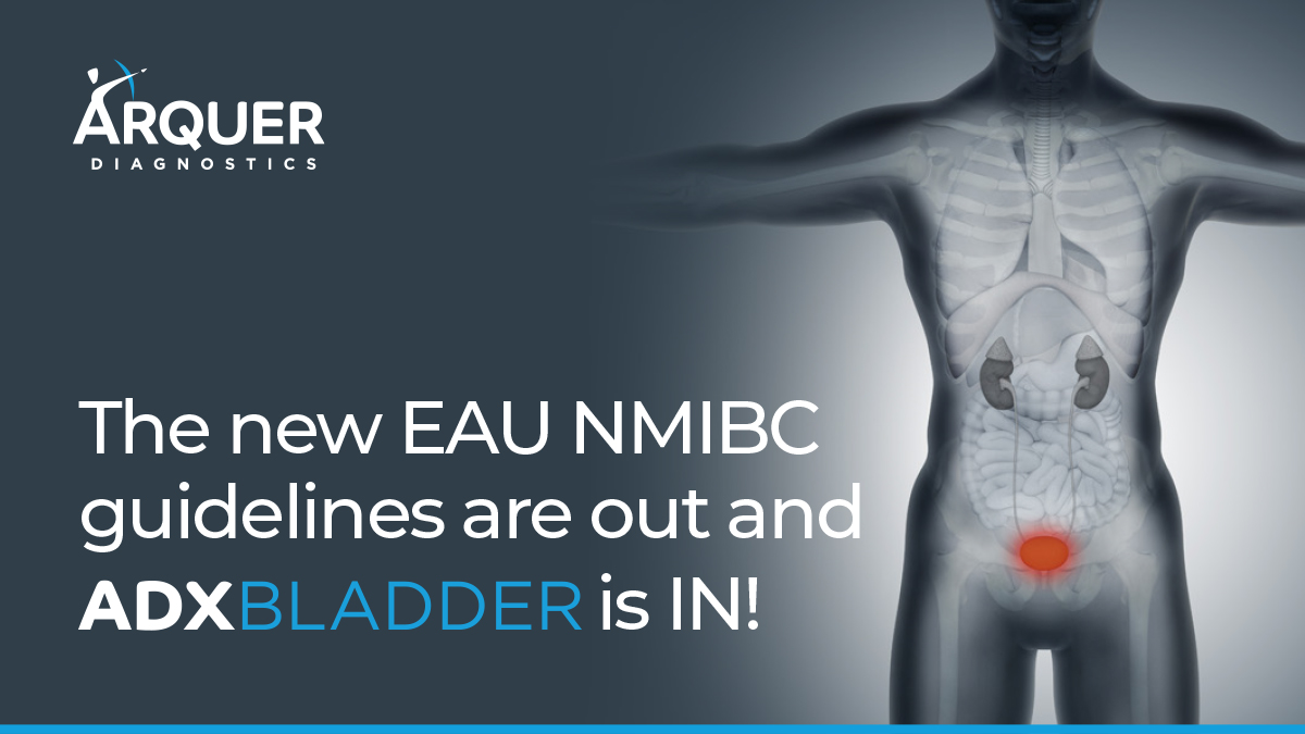 ArquerDx's tweet photo. The new EAU NMIBC guidelines are out and #ADXBLADDER is IN! Urinary #biomarkers may be used to replace and/or postpone #cystoscopy in low/intermediate risk patients: Patients now have a safe and non-invasive alternative! #bladdercancer https://t.co/vjXWvFXd4F