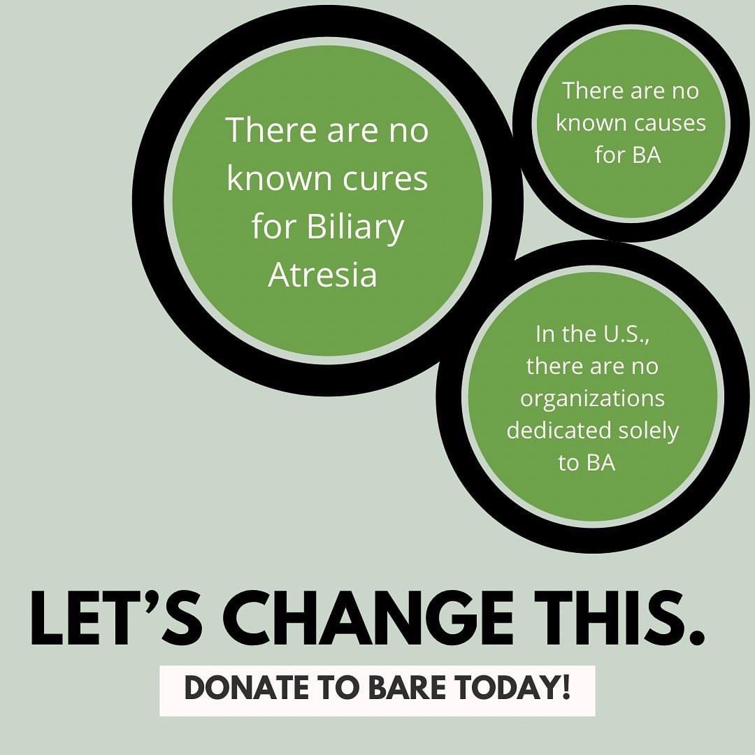 BAREInc_org's tweet photo. Day 2 of our fundraiser and we are just shy of our first $500 and would be honored if you helped us reach our $10,000 goal this week!

To Donate: https://t.co/RuopC0fPJv

Thank you for your support! 

#bare #pediatricliverdisease #research #education #community #fundraise https://t.co/y1sCoveY7r