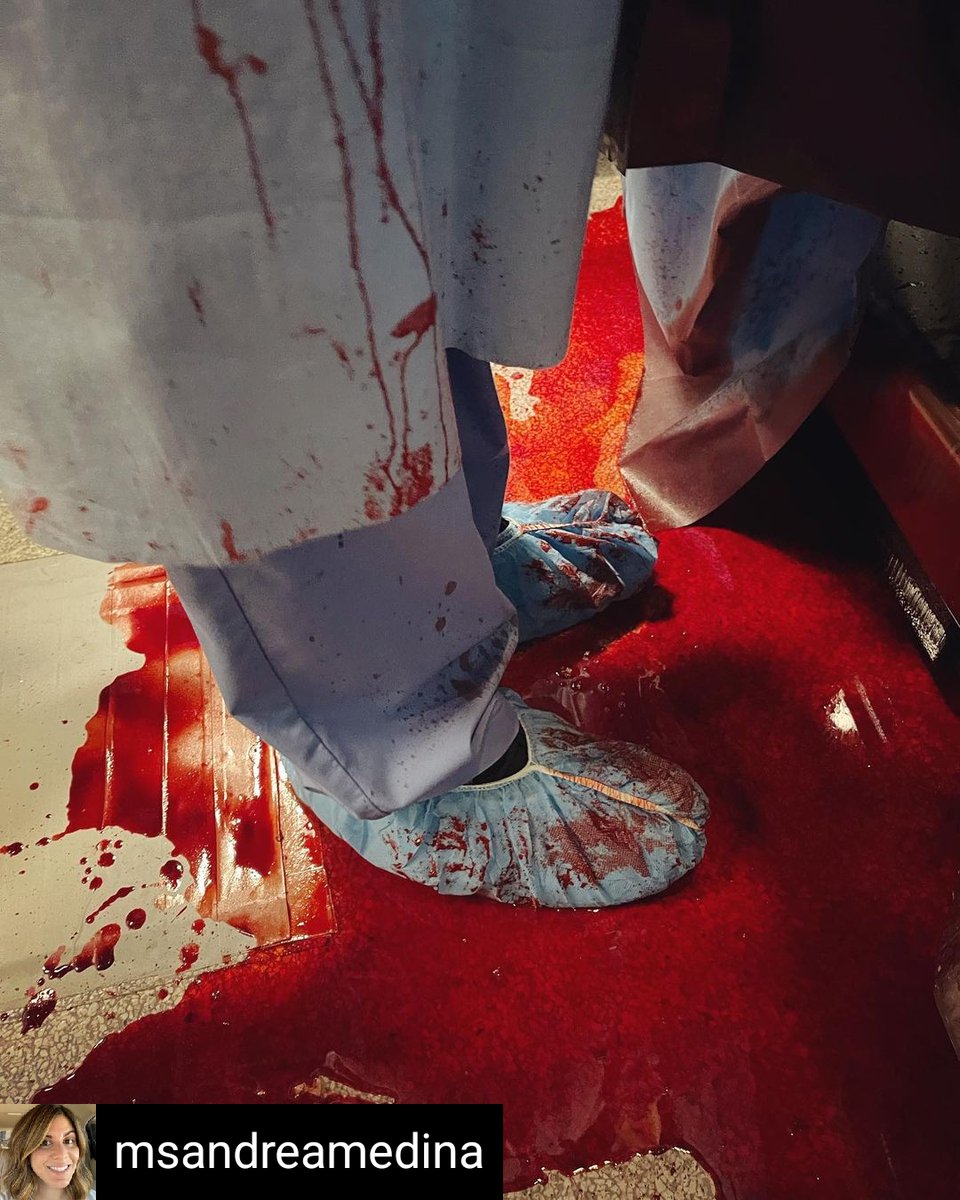 MPC705's tweet photo. Repost From IG #mpc705 # Costumer Andrea Medina.
One of my jobs as a #SetCostumer for #GreysAnatomy is to work with fake #blood!!🩸Multiple O.R. gowns had to be identically bloodied to accomplish all the takes we did... #greys #bts #motionpicturecostumers #iatse #iatse705 https://t.co/rJQtOLeRDN