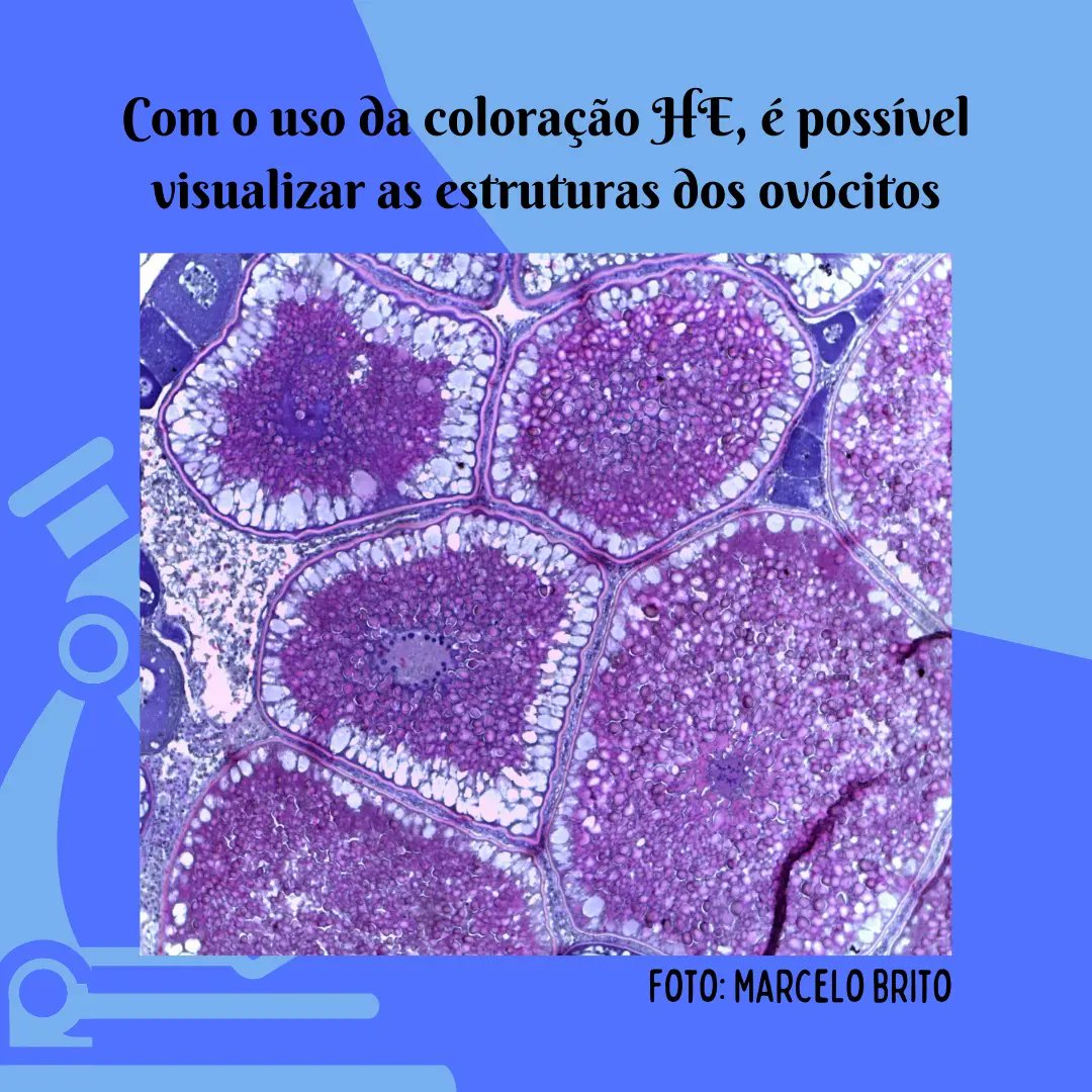 labictioufs's tweet photo. Você sabe como funciona a caracterização microscópica das gônadas? 

Venha saber mais! Acesse o link abaixo! ⬇️

https://t.co/bBlXkIDZCA https://t.co/BX8pCn8IKx