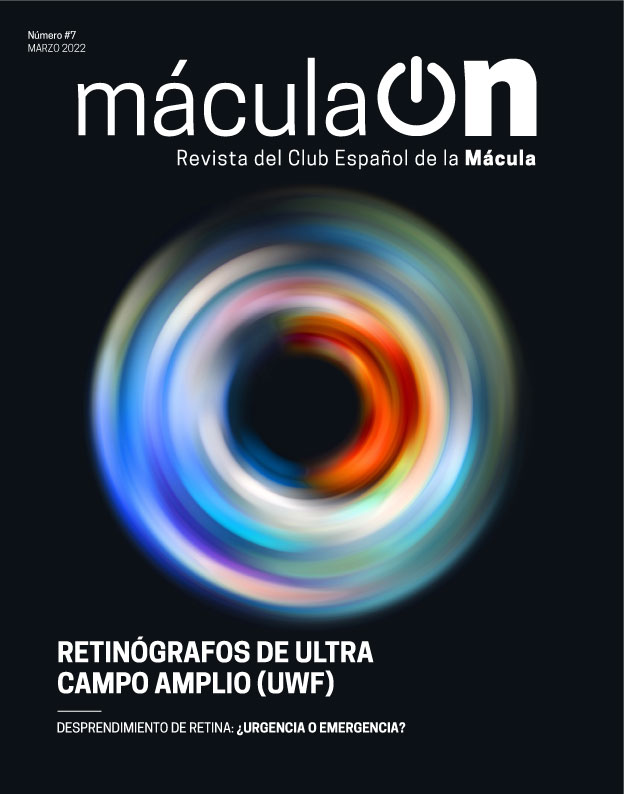 Agilidad, dinamismo y mucho conocimiento son,  las claves que definen la agenda del CEM este mes de marzo y los parámetros sobre los que se ha estructurado este nuevo número de Mácula ON. Energía CEM en estado puro. #ConocimientosCompartidos  #EspírituCEM  clubespanoldelamacula.es/numero-7/