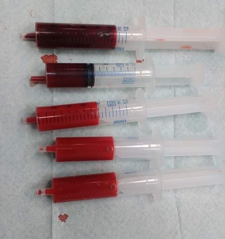 Sangre venosa vs sangre arterial