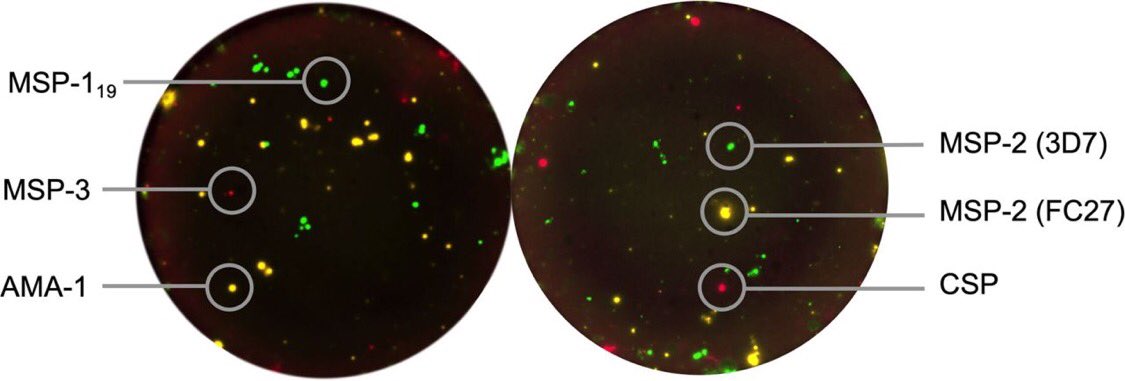 jahnmatz's tweet photo. Honored to share our latest publication with @farnert_lab and @KEMRI_Wellcome and @Mabtech Here, we used the FluoroSpot assay to investigate the association with #malaria-specific MBCs and the link with protection in children living in #kenya https://t.co/Y940sXc551 https://t.co/9bA6HmBW0H