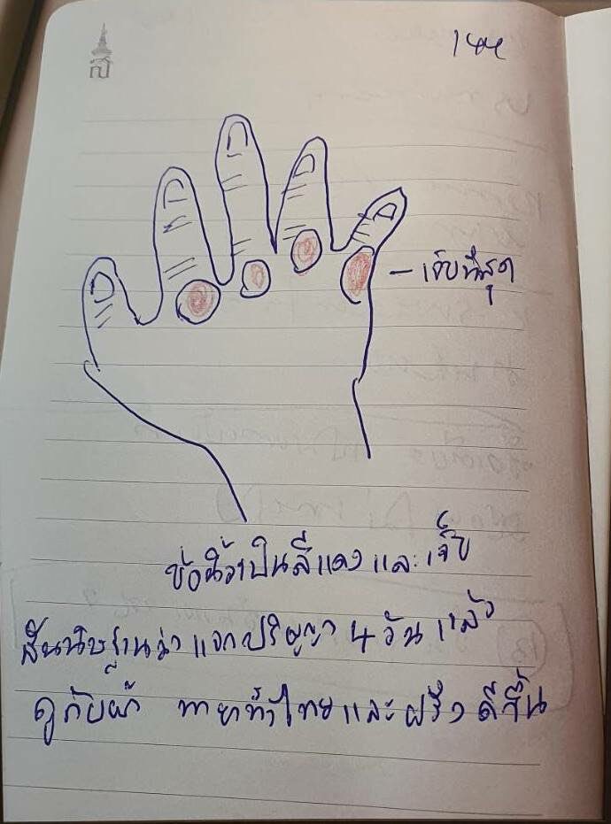 Earth2204's tweet photo. 🙏 ภาพบันทึก​อาการ​เจ็บ​มือ 🙏
ข้อนิ้วเป็น​สีแดงและเจ็บ​ สันนิษฐาน​ว่าแจกปริญญา4วันแล้ว​ ถูกับผ้า​ ทายาทั้งไทยและฝรั่ง​ดีขึ้น

#เรารักกรมสมเด็จพระเทพ​ 
#ภาพถ่ายฝีพระหัตถ์​ 
#เรารักสถาบันพระมหากษัตริย์ https://t.co/0eC43JkKC8
