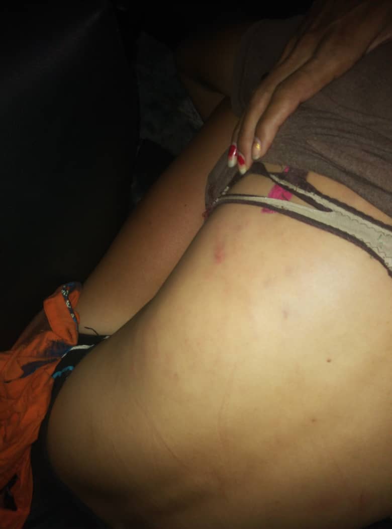 BajoLaLupaInfo's tweet photo. #Ahora Una mujer salvajemente golpeada por su pareja en Villarosa. Vecinos llamaron al @Ven911Ne y se activaron. Tenía politraumatismos. La llevaron hasta el @HLO_IVSS . 
El sujeto que la golpeó, fue detenido y será presentado ante Tribunales, según  Director Daniel Gómez #15Mar https://t.co/iMZdrmEAW9