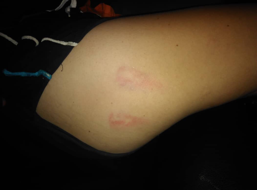 BajoLaLupaInfo's tweet photo. #Ahora Una mujer salvajemente golpeada por su pareja en Villarosa. Vecinos llamaron al @Ven911Ne y se activaron. Tenía politraumatismos. La llevaron hasta el @HLO_IVSS . 
El sujeto que la golpeó, fue detenido y será presentado ante Tribunales, según  Director Daniel Gómez #15Mar https://t.co/iMZdrmEAW9