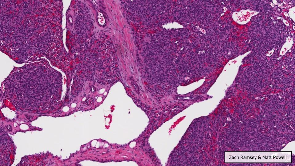 Georgia Association of Pathology (GAP) tweet media