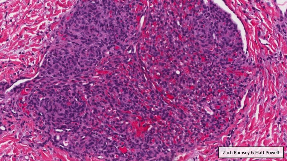 Georgia Association of Pathology (GAP) tweet media