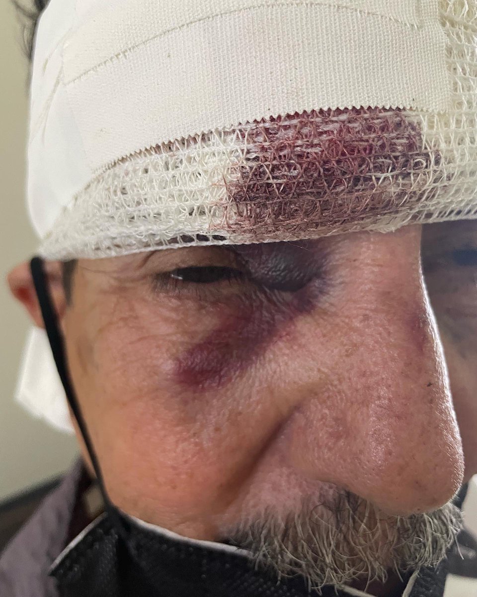Neura_lo's tweet photo. JUSTIÇA SERÁ FEITA, O QUE FEZ COM O MEU SOGRO IRÁ PAGAR!!!!!!!!!! me ajudem e compartilhem!!!! @recordtvrio @geglobo @tvglobo @jornalextra @tinojunior @BGRiodeJaneiro https://t.co/xDZFYIcbym