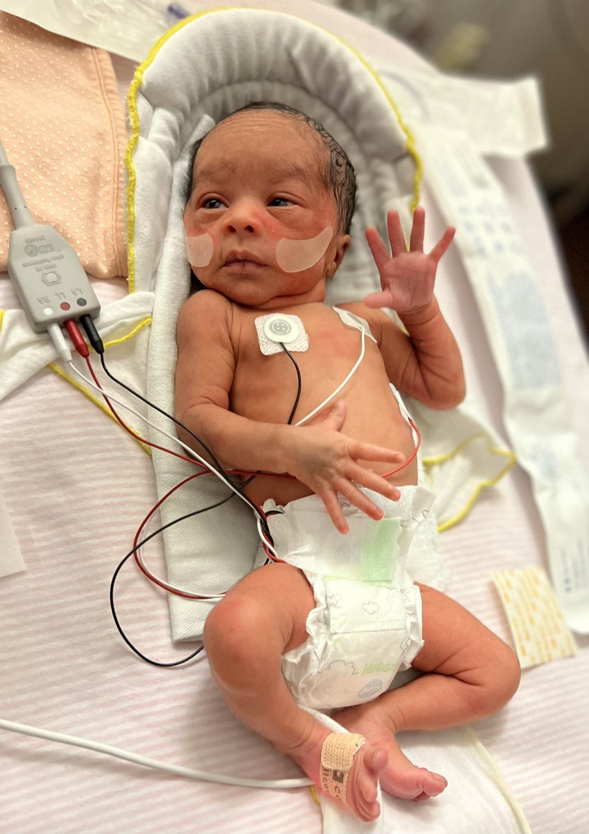 BrionnaLWilson's tweet photo. Briley Brielle Wilson 💜 Our little fighter! #NICUJourney #PPROM https://t.co/yvNQl65xnY