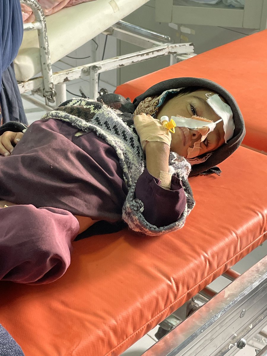 yogital's tweet photo. ‘Hundreds of children in my village are malnourished. In every house, you’ll find 2 or 3. We have nothing to feed their mothers, that's why they're being born like this,’ a man in Helmand said. Malnutrition measles &amp; TB are killing #Afghanistan’s children. https://t.co/1440LEsmJu https://t.co/dvLBhz0p2m