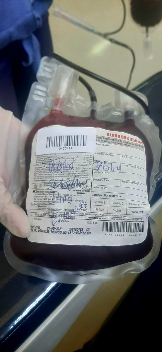 ሌላ ሰበብ ሳያስፈልገኝ ሳልውል ሳላድር ይኸው አሁን ደም ለግሻለሁ🤗 የሰው ህይወት ማዳን ከምንም በላይ ለህሊና እርካታ ነው❤
እየፆምንም ቢሆን ህይወት እንስጥ ❤
#ደምእንለግስ #donateblood 
@Senaitbitew ተባረኪ ሰኒዬ🙏 <a href="/EthiopianBlood/">Ethiopian Blood & Tissue Bank Service❣️</a>