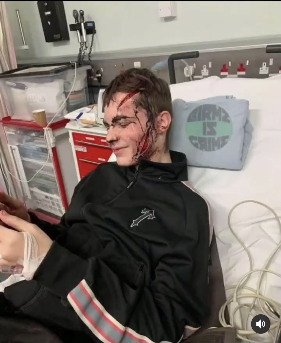 This happened to a 15 year old in Redditch 🙏🏾 wish you well mate.