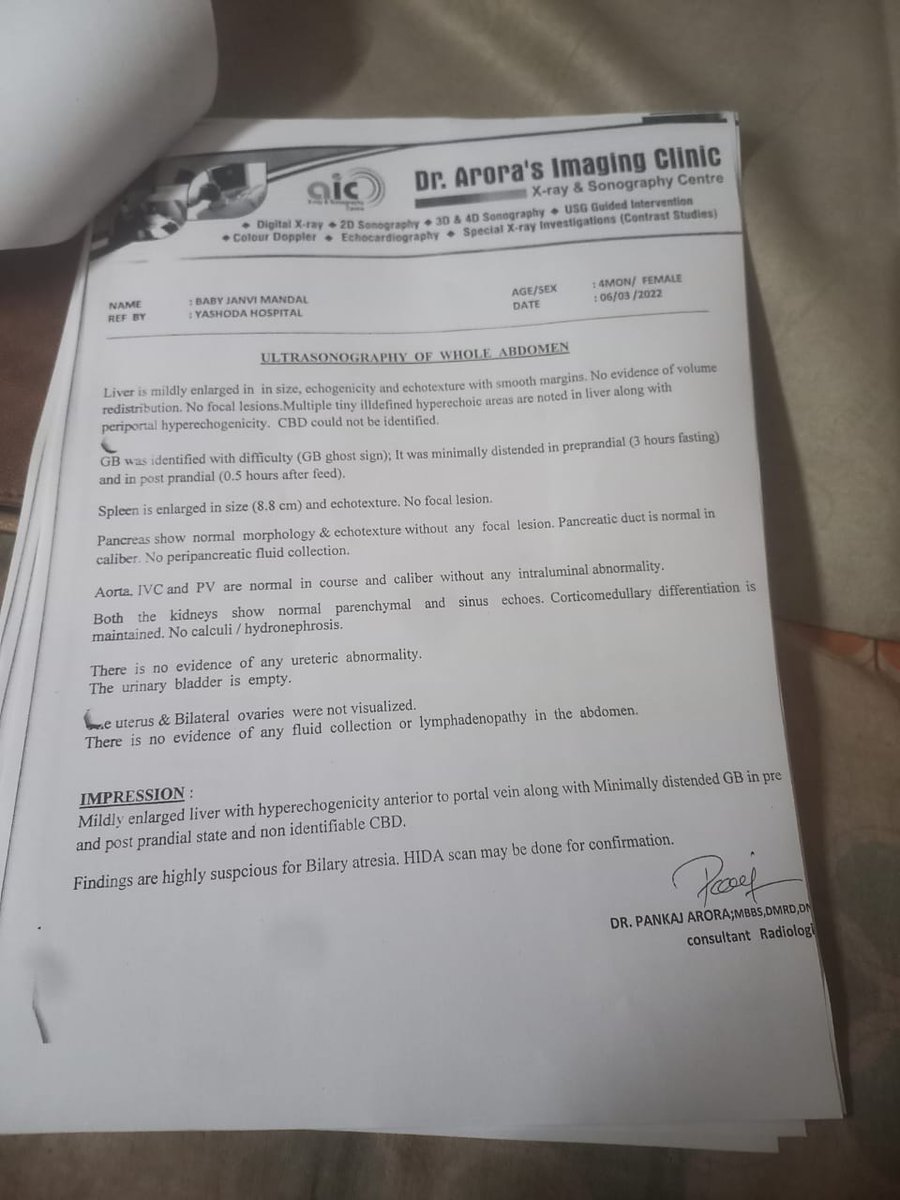 BawaliBablu's tweet photo. Hello sir @TS_SinghDeo ,
Janhavi mondal (6 month old baby) need your help. 
Her liver is damaged and doctor said that it needs to be replaced. 
We need funds to help her out .
Please help !!! Please check attachment https://t.co/aKXS0vDHOI