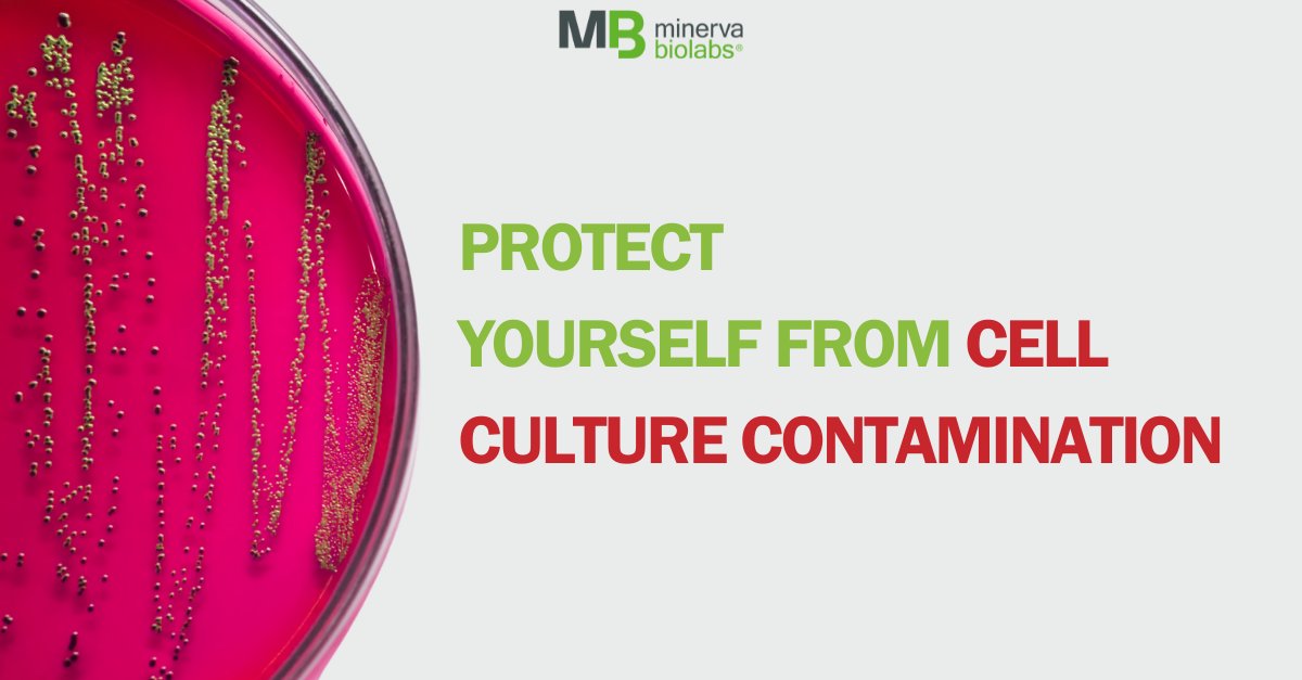 minervabiolabs's tweet photo. #Learn how to protect your #cell culture from #contamination!
https://t.co/MWOZqIByeM
#Biotechnology #blog #biotechblog #Science https://t.co/B5C11PXCWS