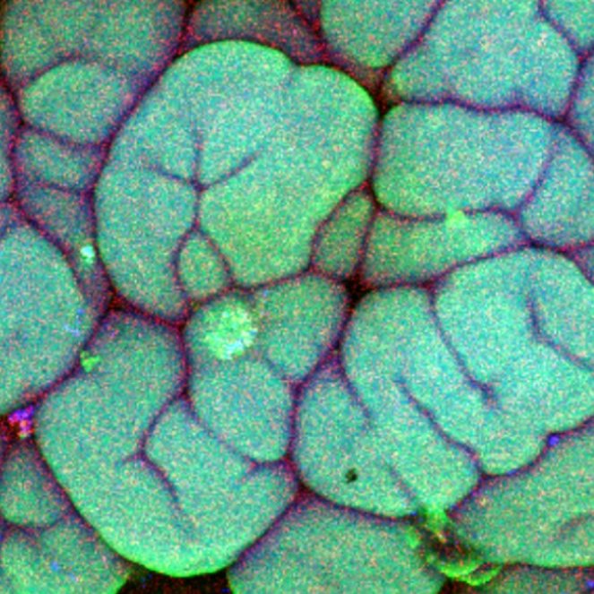 ukbiofilms's tweet photo. 🦠🧑‍🔬On #BritishScienceWeek take a look at our #Biofilm Image Gallery, which contains a selection of beautiful images from our #BiofilmsInTheLab and #BiofilmsIRL #photography competitions! 

🖼️ Visit the gallery https://t.co/ToeMKGw2lC

#BiofilmAware #BSW22 #BritishScienceWeek2022 https://t.co/uY5JTgeDNc