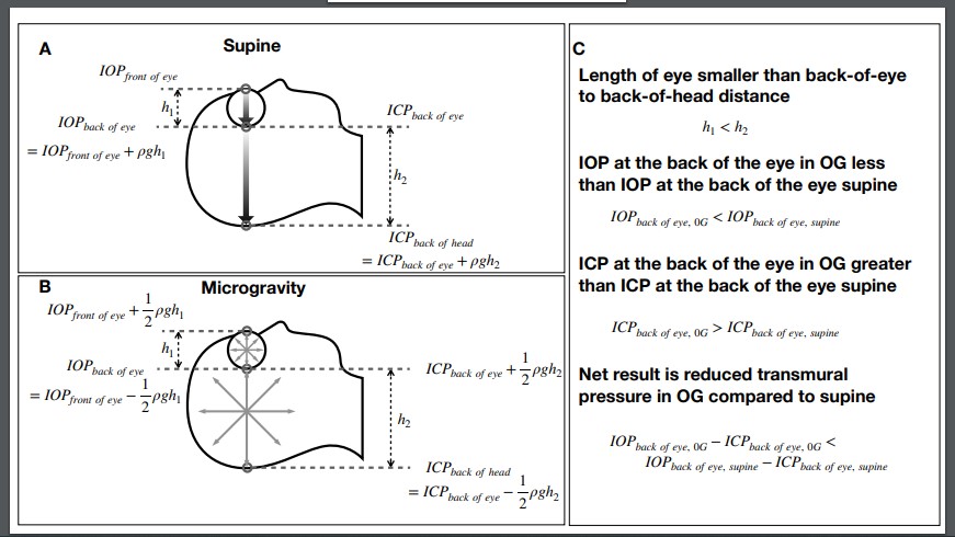 japplphysiol's tweet photo. #ArticlesInPress #Viewpoint “A theory for why the spaceflight-associated neuro-ocular syndrome develops” By: Jay C. Buckey et al. 
https://t.co/ek76OUaQF8
#JAPPL #Microgravity #NumericalModel https://t.co/tD9hm7mBnD
