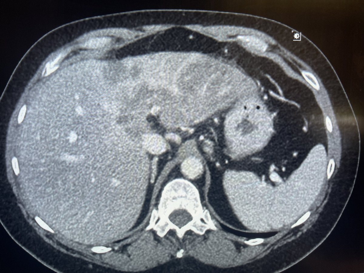 Pankit Parikh tweet media