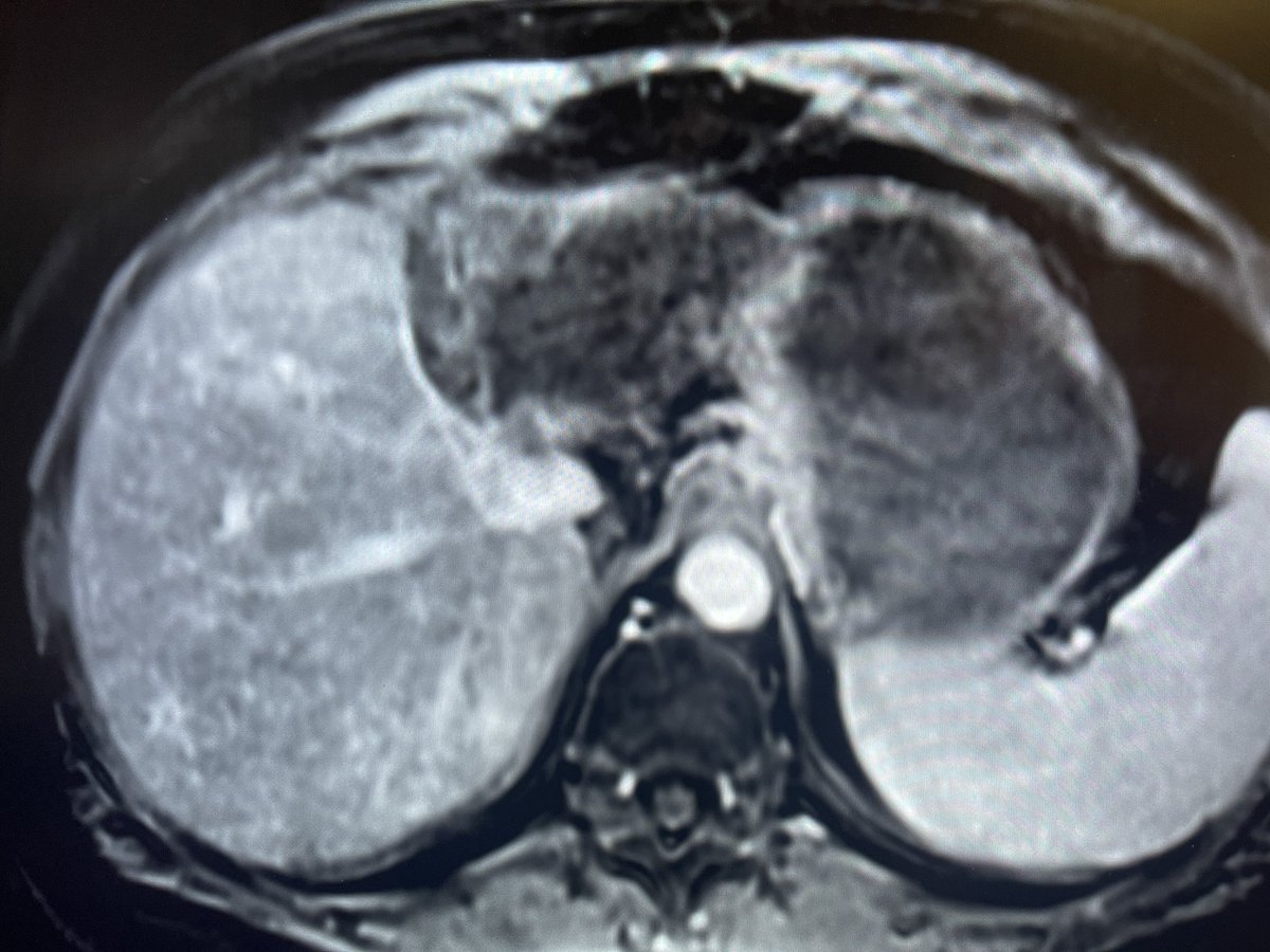 Pankit Parikh tweet media