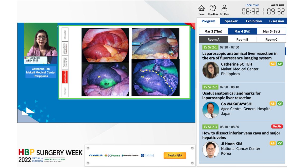 hpbsurgeon1's tweet photo. Meanwhile at the #KAHPBS + @ILLS joint session, great discussions. In the era of #fluorescence systems, #ICG complementing #LAPUS may enhance precision in #LALR. Knowledge and utilization of anatomical landmarks are prerequisites to achieve #precisionLALR @DiagnosticGreen @isfgs https://t.co/9xfiMp7sDl