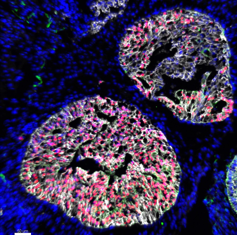 Muneralab's tweet photo. First tweet on #FluorescenceFriday #organoids #humanintestinalorganoids #microscopy #cellbiology #sciart #bioart https://t.co/bsEnkwEoHT