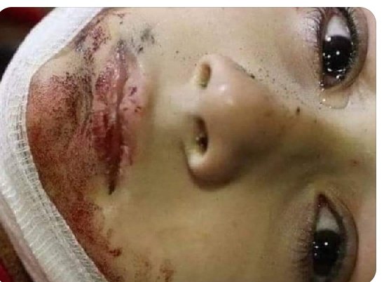 Bashara98677642's tweet photo. Which islamic theory will you give to this child who was mayrtd In Peshawar mosque during Friday prayers.
#Peshawar Attack
#Shiagenocide 
@PakPMO  you are failed to protect Minorities.
@mwmpakofficial  stand by uh in this though time. https://t.co/AJzuIRuM0p https://t.co/4An2WOd14v