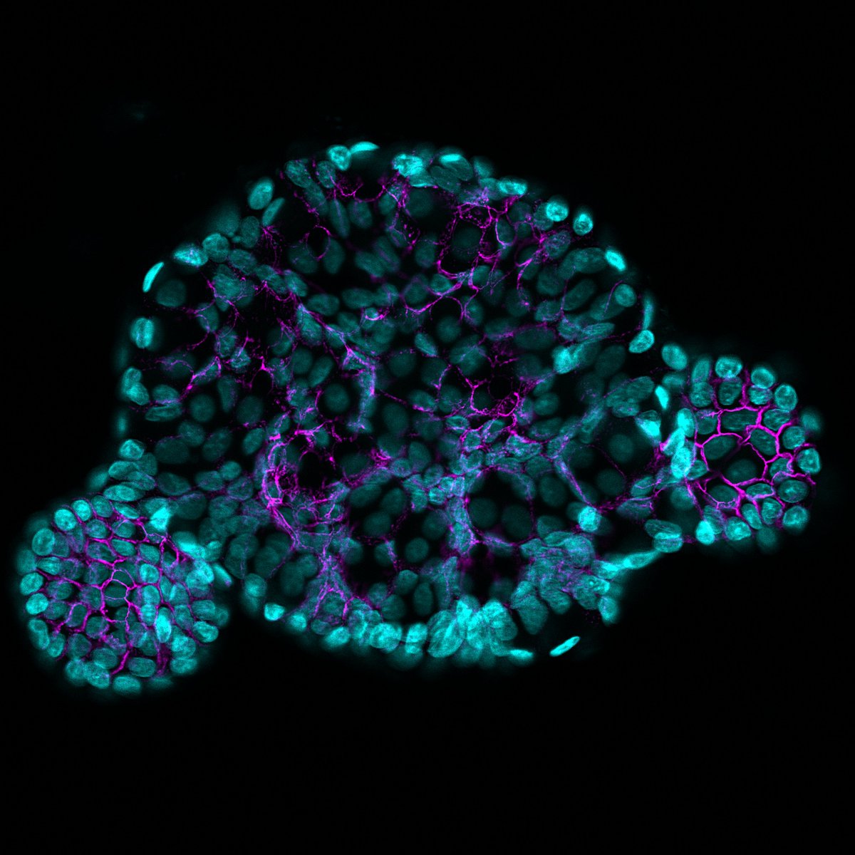 Baby enteroid! 🥰 Infant derived jejunal enteroid stained with DAPI (cyan) and E-cadherin in purple. Imaged with the glorious AiryScan. #FluorescenceFriday