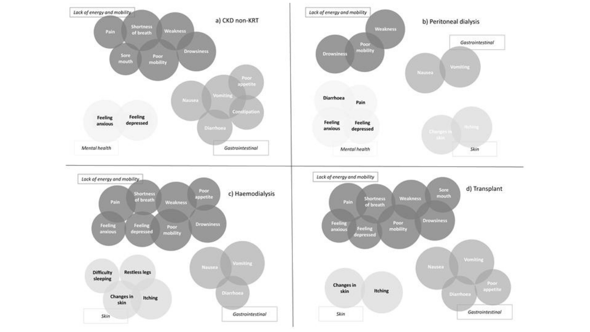UKKidney's tweet photo. New study using UK #RenalRegistry #data identifies symptom clusters in adults with #CKD across treatment groups &amp; investigates their association with people’s ability to perform usual activities. 📄

https://t.co/n5ECST1SIq

#UKRR #@currie_moore @fjcaskey @tomwilks444 https://t.co/Mwe80WmSsT
