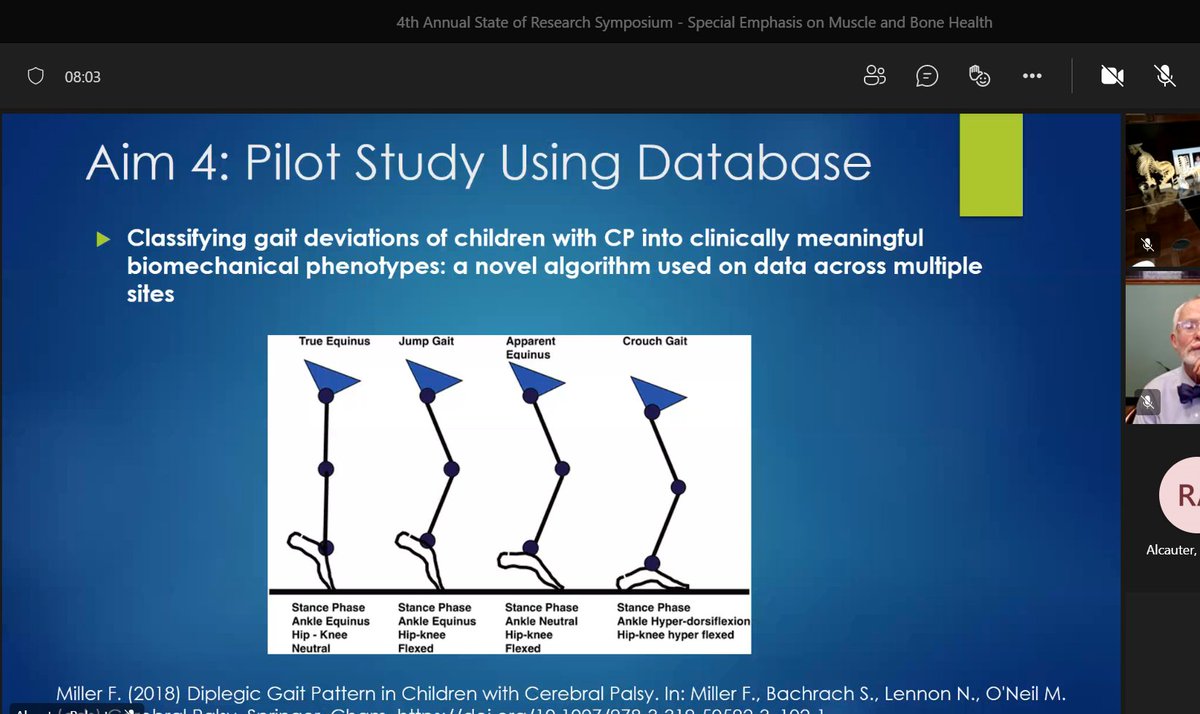ShrinersChicago's tweet photo. Pilot study of #cerebralpalsy patients 5000 walking trials. 4 #Motionanalysis @shrinershosp sites. Narrowed to 3 CP classifications, with treatment implications. Goal to automate analysis. Shriners has decades of data. #StateofResearch #gait #data #shrinerschildrens https://t.co/bLLH0Oms20