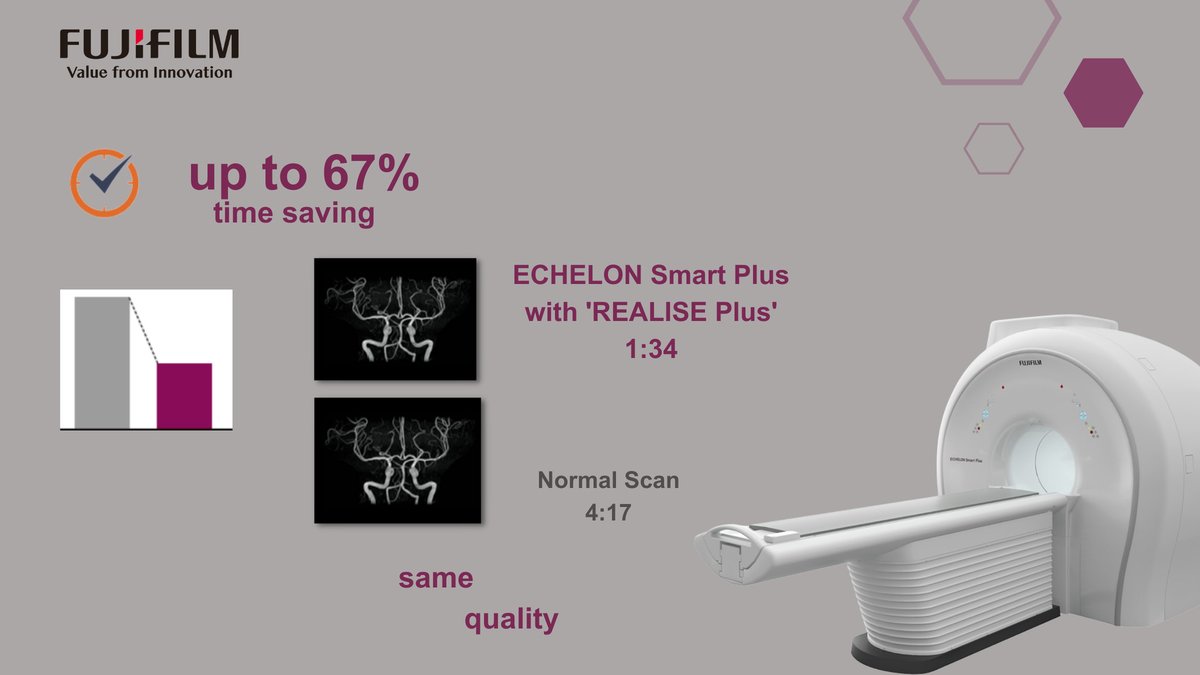 Joao_B's tweet photo. ๐ It's time to stop debates about scan time & its impact on #MRI image quality!
#ECHELONSmartPlus with #SynergyDrive now features #REALISEPlus and is able to reduce scan time by up to 67%
๐ https://t.co/HVUr7IIFCq
#digitalhealth #ehealth #telehealth #Radiology #ECROverture https://t.co/QHvzPtpyxz