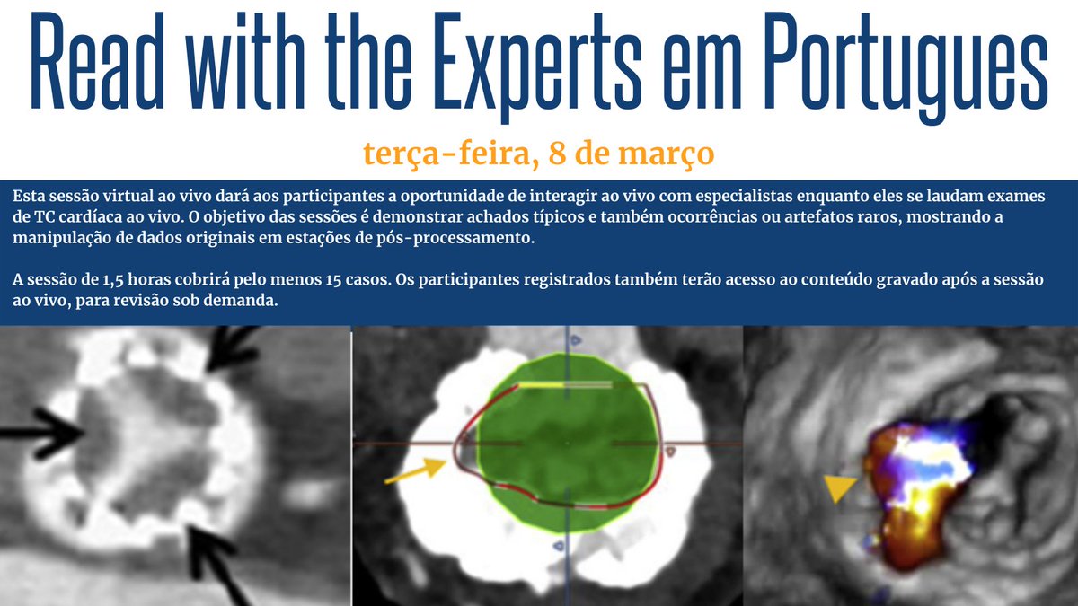 Read with the Experts in Portuguese | Mar. 8 Experts will explore cases, providing clinical background info such as age/gender/prior history & why CT was performed as well as validation or outcome info. 👉ow.ly/F6lZ50I9tK3 @MBittencourtMD @Clerioazevedo @RCardoso_MD