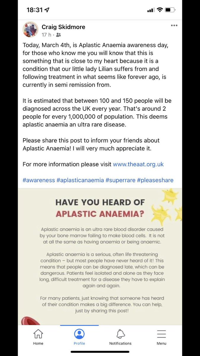 #Aplasticanemia Awareness day please help us raise awareness Retweet for us Thankyou ❤️