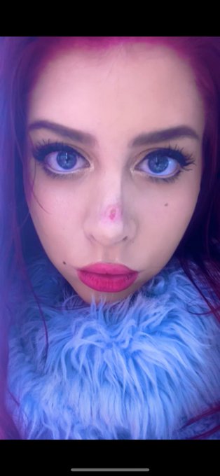 1 pic. Btw… everyone commenting/dming about my nose looking different… it is different! I had an awful