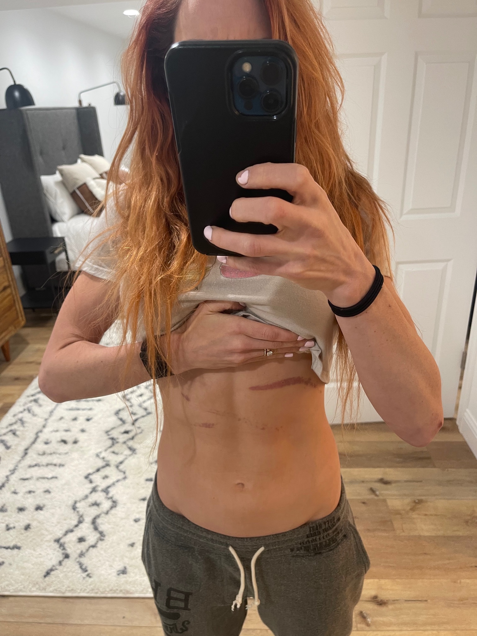 WWE Raw Champ Becky Lynch’s Daughter Isn’t Looking At Her Mom’s Bruises 2