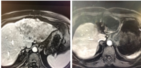 Justin Stenz, MD tweet media