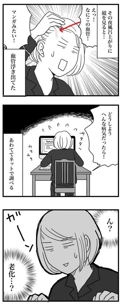 2日後に血管は消えましたが、
また出たりするのかな。 