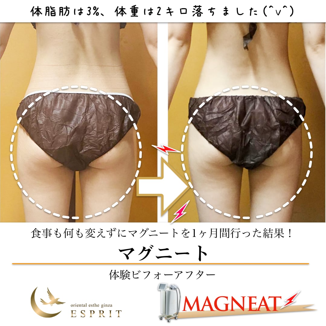 痩身 肌改善専門オリエンタルエステ エスプリ 銀座 新宿 エステサロン 痩身エステ ビフォーアフター 画像は食事も何も変えず マグニートを1ヶ月間行ったダイエットの結果です 背中 お腹 お尻しかやっていないのに 二の腕と太ももがスッキリ 今
