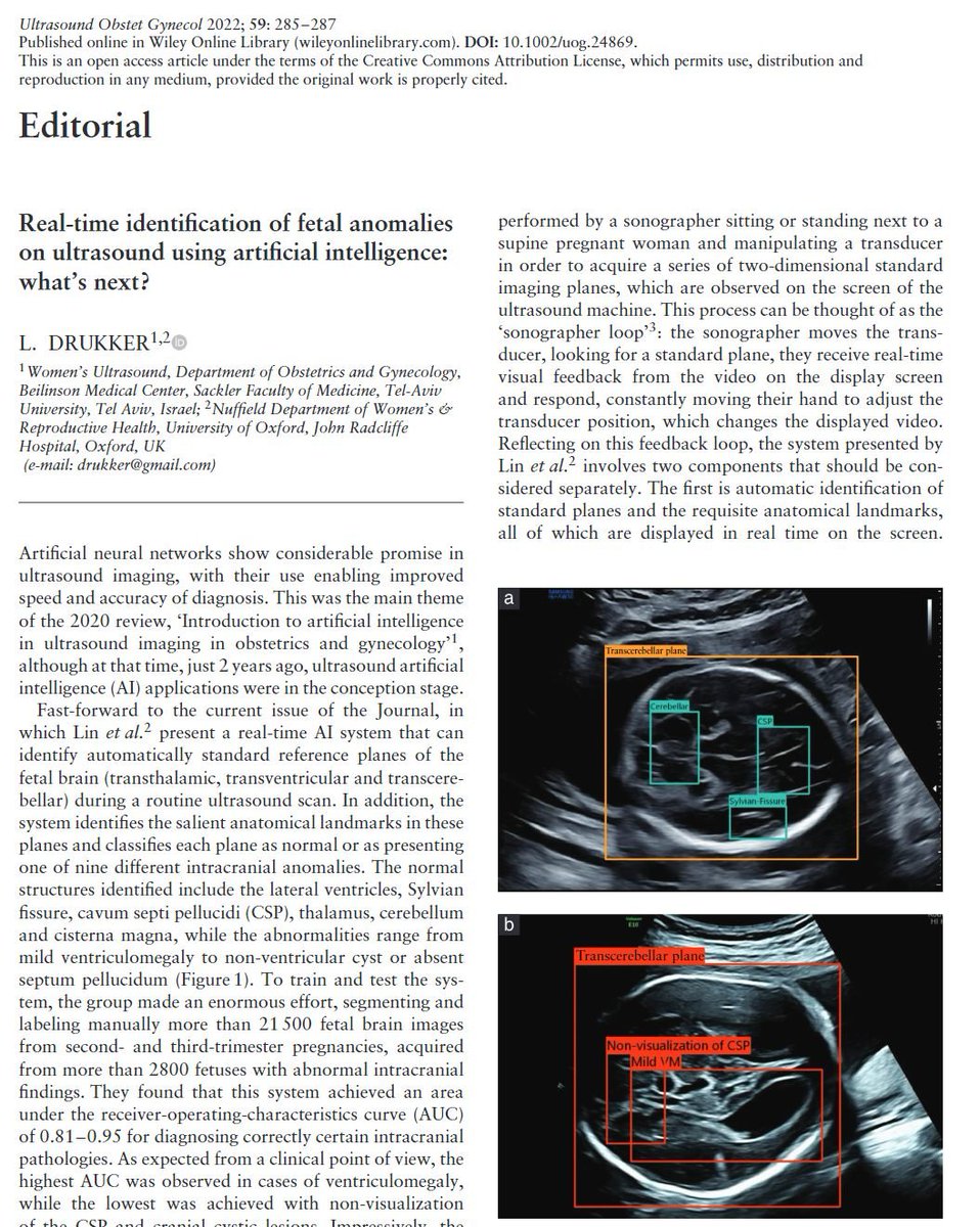 Lior Drukker tweet media