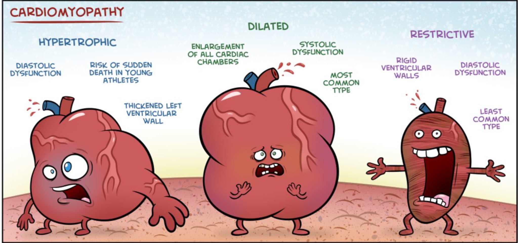 cardiomyopathy - Twitter Search / Twitter