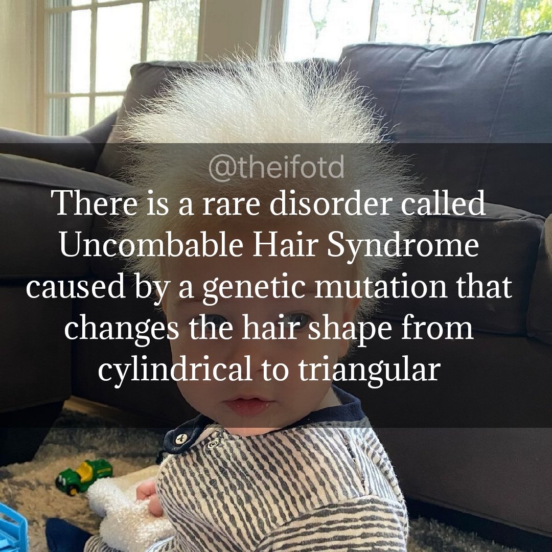theifotd's tweet photo. #uncombablehairsyndrome #uhs #hair #crazyhair #badhairday #genetic #geneticdisorder #ifotd #interesting #fact #learnsomethingneweveryday #learnsomethingnew #todayilearned #goodmorning #morning #daily #facts https://t.co/gFLwDRqaze
