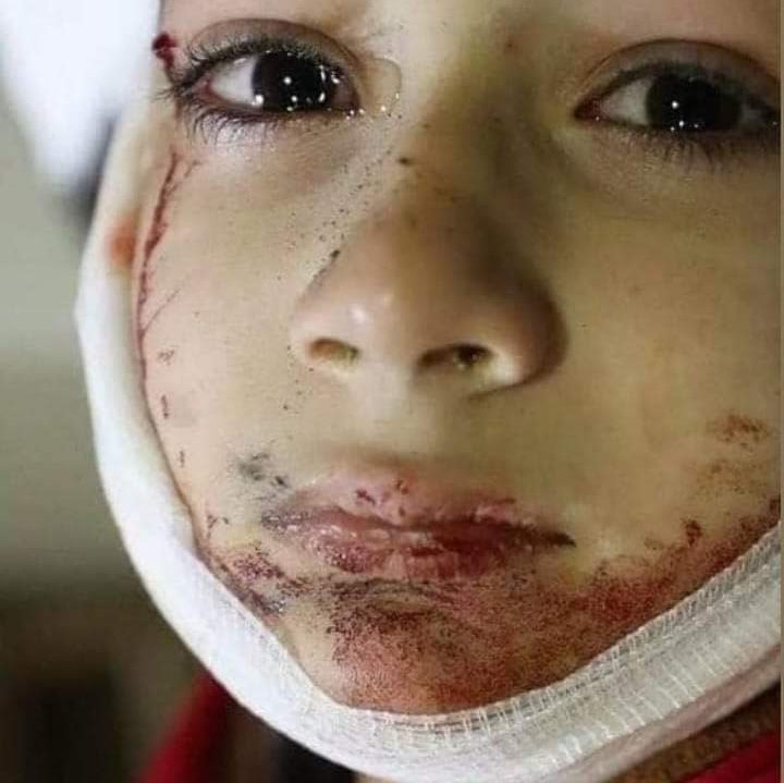 SheikhAdnanMus1's tweet photo. پشاور جامع مسجد بم دھماکہ میں پارا چنار سے تعلق رکھنے والا ننھا شھید حسن عباس.
اس کا کیا قصور تھا۔💔
#StopShiaTargetkilling #PeshawarBleedsAgain https://t.co/uNIUBX6IJ6