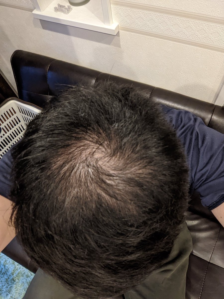 おでこ広い男がモテるには隠さずに短髪にするのがポイント