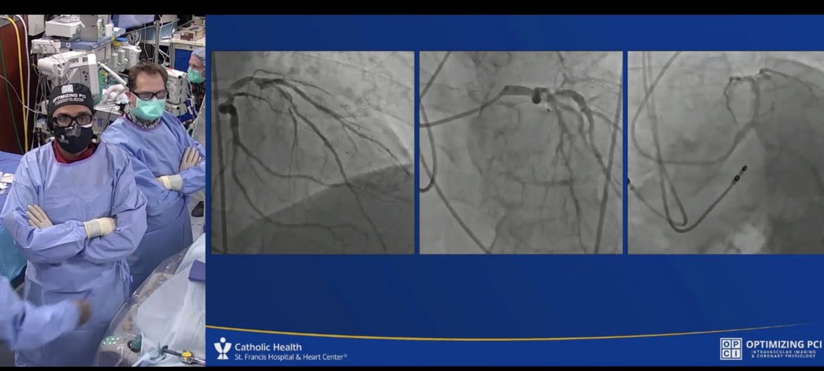 APSIC6's tweet photo. #OptimizePCI @OptimizingPCI @APSIC6 @Dr_AshokSeth
Live case: imaging & plaque modification @ziadalinyc @DrAllenJ
How would you treat?
@AsiaInterv @PCRonline https://t.co/M1NTjD1cfh