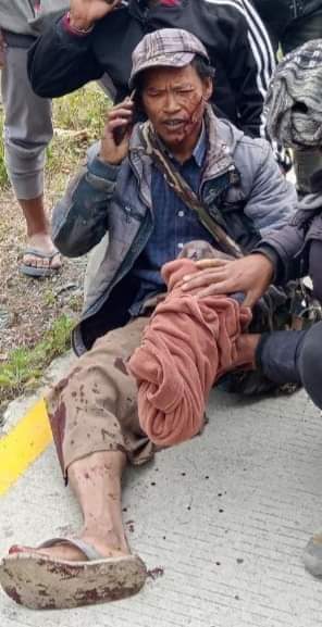 A 48-yr-old pastor of Ramthlo Baptist Church lost his left leg after stepping on a landmine panted by junta troops on the way back to retrieve things from his village. His entire village was sent fleeing &amp; hiding in the jungles as junta convoy passed through the village this week